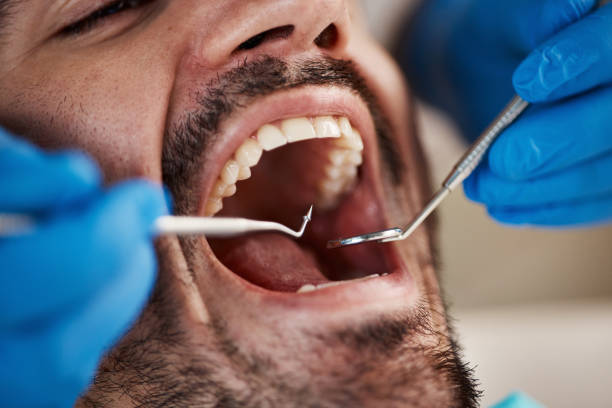 Full Mouth Reconstruction in Cricket, NC